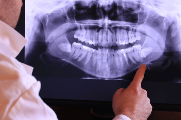 Best Emergency Treatment for Jaw Pain or Injury in Tarkio, MO