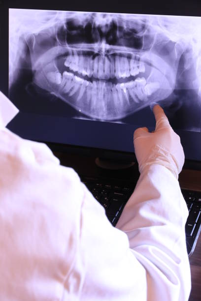 Best Dental Abscess Treatment in Tarkio, MO